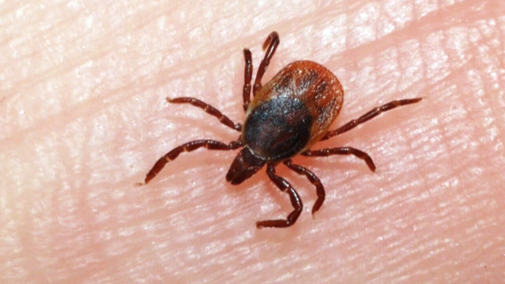 Woman warns about Lyme disease risk in MTL parks