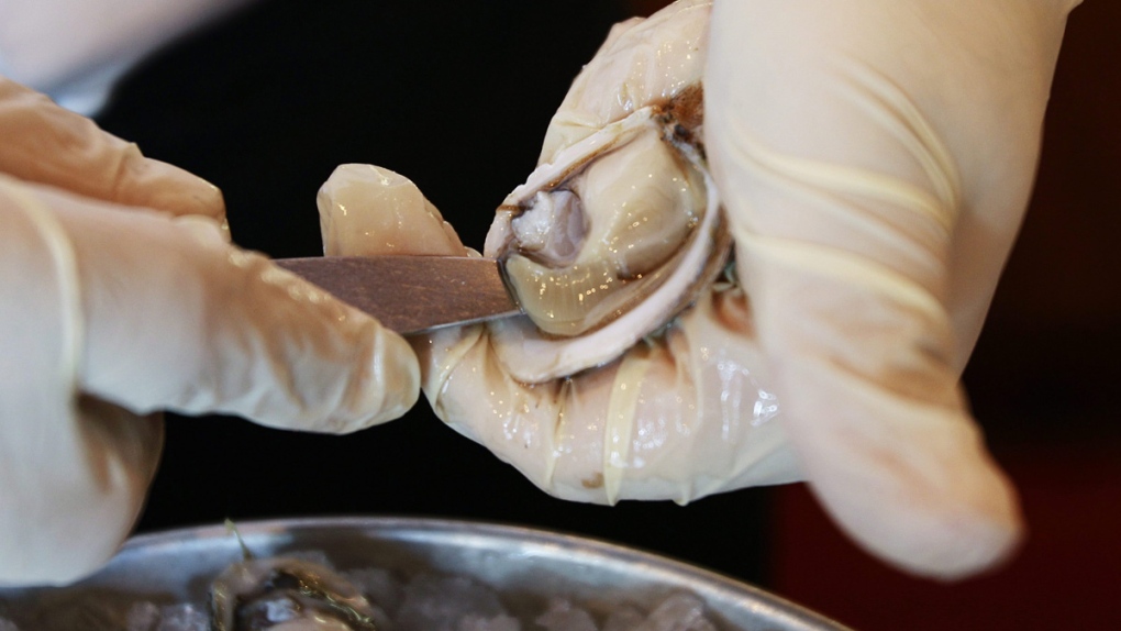 A Pacific oyster is shucked in this June 18, 2010 file photo. (Ted S. Warren / AP)