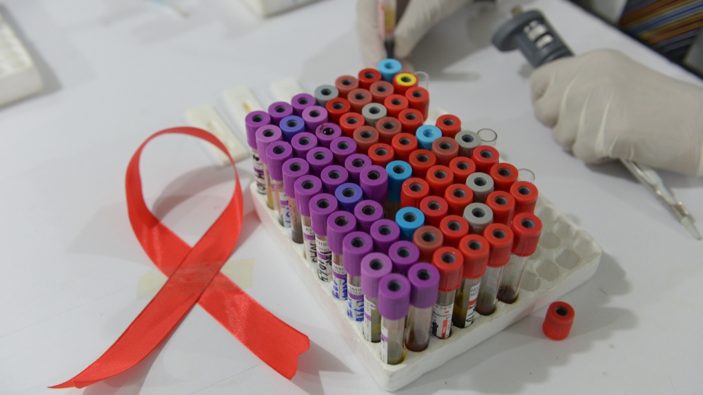 The U.S. Food and Drug Administration has approved the first injectable medication for pre-exposure prophylaxis (PrEP) to lower the risk of getting HIV through sex, it announced December 20. (FAROOQ NAEEM/AFP/AFP/Getty Images via CNN)
