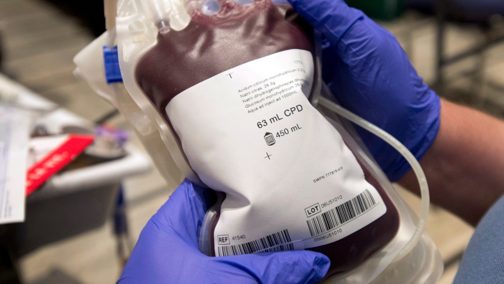 A bag of blood is shown at a clinic. THE CANADIAN PRESS/Ryan Remiorz